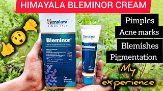 Himalaya Antiblemish cream BLEMINORUses Side effects Honest review 🔥 [upl. by Silda]