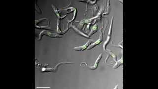 Trypanosoma brucei hypoosmotic shock [upl. by Lledra]