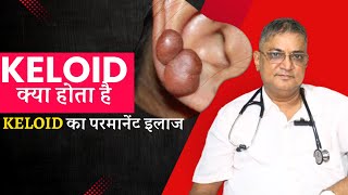 Get Rid Of Keloids Forever Effective Keloid Treatment By Dr Naren Pandey [upl. by Glenn]