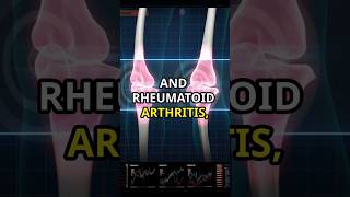 Understanding Arthritis 60Second Guide Learn symptoms causes and types ArthritisAwareness [upl. by Naujak]