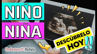 Cómo saber si es NIÑO o NIÑA por Ultrasonido  SEMANA 12 a 20 ¡Detecta las diferencias [upl. by Tice625]