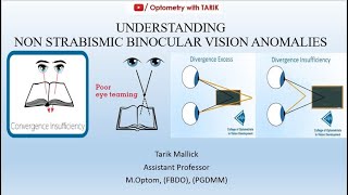 Understanding Non Strabismic Binocular Vision Anomalies [upl. by Lampert762]