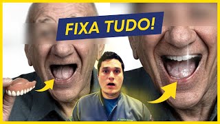 COMO FIXAR A PRÓTESE DENTÁRIA INFERIOR [upl. by Nieberg965]