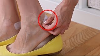 Having Foot Blisters  Here are 6 Best Ways to Prevent Foot Blisters  StayFitNaturally [upl. by Alohcin]