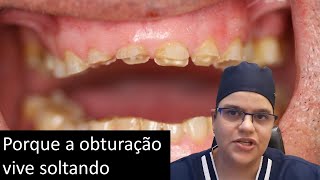 Bruxismo solta restaurações Master Pride Odontologia  Dra Bianca Rosa [upl. by Comptom]