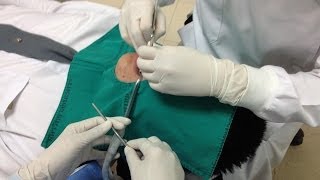 Instrument transferring for dental students and dental assistants [upl. by Leur549]