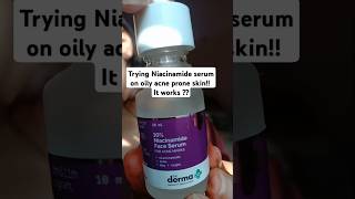 Best niacinamide serum for oily acne prone skin beginners niacinamide serum review youtubeshorts [upl. by Tudela]