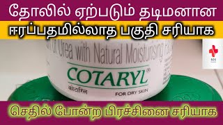 Cotaryl Cream uses in Tamil ichthyosis eczema Hyperkeratotic skin cracked feetSOSPHARMACISTTAMIL [upl. by Onifur]