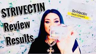 STRIVECTIN NECK CREAM REVIEW FINAL RESULTS [upl. by Manara]