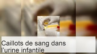 Signification et causes des traces de sang et caillots dans lurine dun enfant [upl. by Tevis]