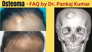 Osteoma  Common Questions and answers Scarless Osteoma Removal surgery How to remove osteoma [upl. by Irrek]