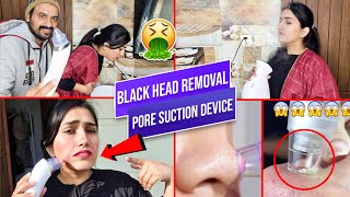 Black Head Removal pore Cleaner Device  blackhead pore vacuum  Does it Work [upl. by Eelrac64]