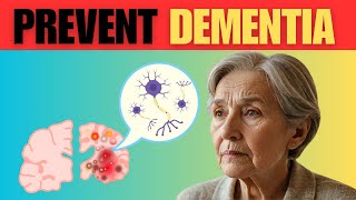 The Early Signs of Dementia and How to Prevent It [upl. by Emlyn195]