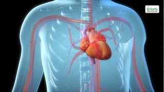 Angioplasty Procedure Animation Video [upl. by Petersen]