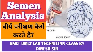 Semen analysis  वीर्य परीक्षण  Sperm count  Semen test [upl. by Zorah]