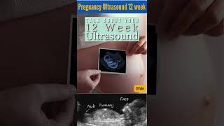 pregnancy week by week development  pregnancy week by week 12 pregnancy ultrasound shorts [upl. by Bow]