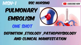 Pulmonary Embolism  part1 Bsc nursing semIII [upl. by Yvette48]