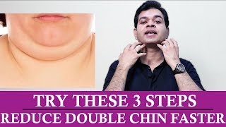 3 Best Exercises to Remove DOUBLE CHIN Quickly How Double Chin can be Reduced PermanentlyTRY THIS [upl. by Louanne]