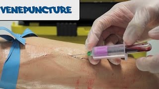 Venipuncture  How to take Blood  OSCE Guide old version  UKMLA  CPSA [upl. by Jenei]