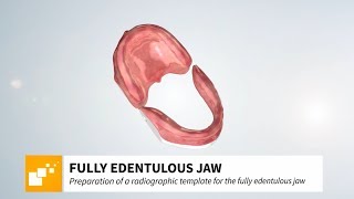 SICAT CLASSICGUIDE  fully edentulous jaw [upl. by Douville]