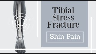 front shin pain  tibial stress fracture [upl. by Aissej]