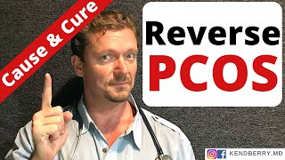 PCOS What Causes PCOS How to Reverse PCOS [upl. by Gatias972]