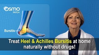 Achilles Bursitis  Retrocalcaneal bursitis Heel bursitis treatment [upl. by Madeline844]