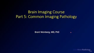 Brain imaging course – 5 – Common imaging pathology [upl. by Bega]