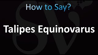 How to Pronounce Talipes Equinovarus correctly [upl. by Ongun]