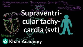 Supraventricular tachycardia SVT  Circulatory System and Disease  NCLEXRN  Khan Academy [upl. by Nisay]