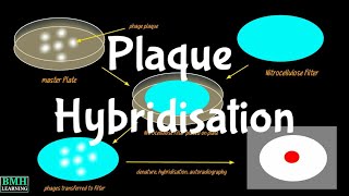 Plaque Hybridisation  Plaque Hybridosation Vs Colony Hybridisation [upl. by Gilligan671]