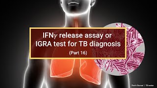 Interferon Gamma Release Assay Test for Mycobacterium Antigens [upl. by Irret507]