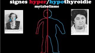 🔴 Dr Astuce  HYPERHYPOTHYROIDIES EXPLIQUÉES CLAIREMENT [upl. by Rettuc]