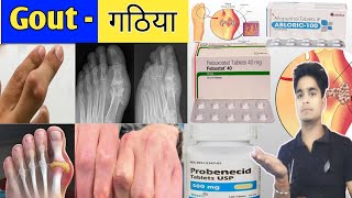 Gout  गठिया बीमारी और दवाइयां  Medicine  Treatment  Pharmacy  Doctor  pharmacy  pharmacology [upl. by Pippas]