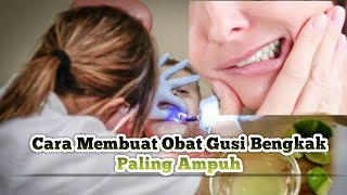 Cara Mengobati gusi Bengkak Secara Alami Dan Paling Ampuh [upl. by Annaeel]