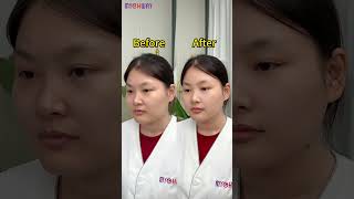 Notice the amazing skin and body transformation 😍 CavitationMachine FacialDevice AntiAging [upl. by Cointon262]