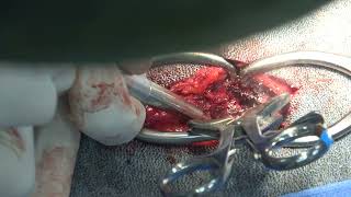 Dorsal laminectomy and subarachnoid diverticulum in a dog [upl. by Rosalinde163]