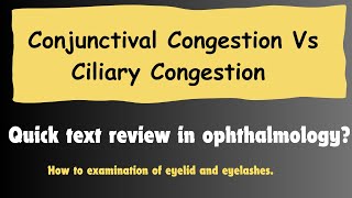 How to differentiate between Conjunctival Congestion and ciliary Congestion OptometryFans [upl. by Anselmi]