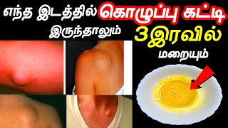 3இரவில் கொழுப்புகட்டி கரையும்  lipoma treatment in tamil  kozhuppukatti  health tips in tamil [upl. by Sara-Ann]