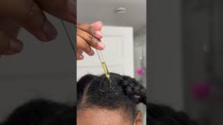 HOT OIL TREATMENT FOR HAIR GROWTH [upl. by Bluefarb]