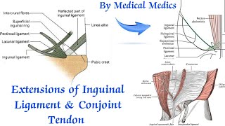 Inguinal Ligament  Extensions of Inguinal Ligament  Conjoint Tendon  Medical Medics [upl. by Eilram]