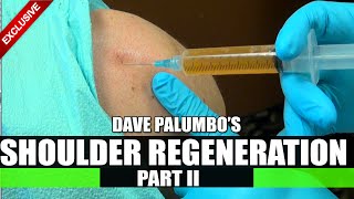 Palumbo Shoulder Regeneration Part 2 Plasma Rich Platelets [upl. by Edgard]