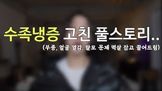 얼굴열감 수족냉증 종아리부종 모발문제는 보통 2개이상 동시 발현 왜일까 [upl. by Odnumde]