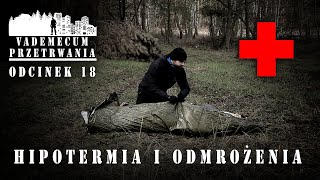 Hipotermia i odmrożenia 🥶⛑ [upl. by Dowd572]