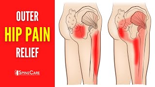 How to Fix Outer Hip Pain FOR GOOD [upl. by Notniuq]