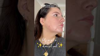 chemical peel by the best ✨ viral trending chemicalpeel skincare aesthetics beauty [upl. by Verity]