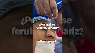 RINOPLASTIA  DR CARLOS GAMBOA [upl. by Mirabel]