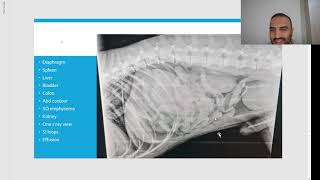 Chapter 6 Lets study X rays 13 الجدPeritonealamp retroperitoneal free fluid amp gas سوائل هواء البطن [upl. by Fredrika]