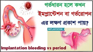 Implantation symptoms Implantation bleeding vs period  how to know the difference [upl. by Sisto]