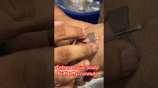 Butterfly cannulation  cannula cannulation trending ivtherapy SMpharmacy plz subscribe [upl. by Ashia]